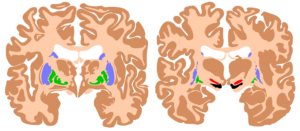 How AI Learns From the Human Brain!